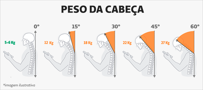 Peso da cabeça de acordo com o grau de inclinação do pescoço